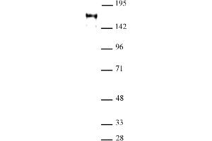 ATAD2 antibody (pAb) tested by Western blot. (ATAD2 Antikörper  (C-Term))