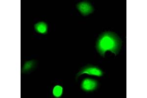 Immunofluorescence staining of MCF7 Cells with ABIN7127508 at 1:50, counter-stained with DAPI. (Rekombinanter Galectin 3 Antikörper)
