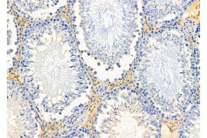 ABIN6256907 and ABIN6274858 at 1/100 staining Rat testis tissue by IHC-P. (Apolipoprotein L 4 Antikörper  (C-Term))