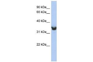 DLK1 antibody used at 1 ug/ml to detect target protein. (DLK1 Antikörper)