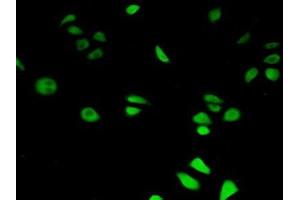 Immunohistochemistry (IHC) image for anti-Hypoxia Inducible Factor 1, alpha Subunit Inhibitor (HIF1AN) (AA 31-349) antibody (ABIN7441979)