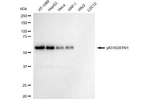 Western blotting analysis using p62/SQSTM1 antibody (ABIN7800299).