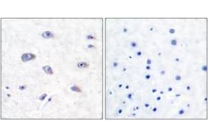 Immunohistochemistry analysis of paraffin-embedded human brain tissue, using BACE (Ab-498) Antibody.