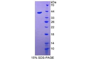 SDS-PAGE (SDS) image for Eosinophil Chemotactic Factor (ECF) (AA 24-97) protein (His tag,GST tag) (ABIN1980608) (ECF Protein (AA 24-97) (His tag,GST tag))