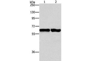 Western Blot analysis of 231 and NIH/3T3 cell using ASNS Polyclonal Antibody at dilution of 1:800 (Asparagine Synthetase Antikörper)