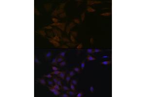 Immunofluorescence analysis of C6 cells using PP2A alpha + beta Rabbit mAb (ABIN7269686) at dilution of 1:100 (40x lens). (PPP2CB Antikörper)