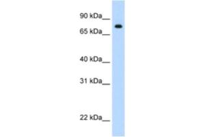 Western Blotting (WB) image for anti-Signal Transducer and Activator of Transcription 1, 91kDa (STAT1) antibody (ABIN2461816) (STAT1 Antikörper)