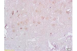 Formalin-fixed and paraffin embedded rat brain labeled with Rabbit Anti ADRB3/beta 3 Adrenergic Receptor Polyclonal Antibody, Unconjugated  at 1:200 followed by conjugation to the secondary antibody and DAB staining (ADRB3 Antikörper  (AA 310-408))