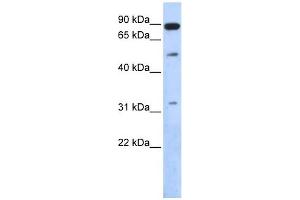SENP5 antibody used at 1 ug/ml to detect target protein. (SENP5 Antikörper  (Middle Region))