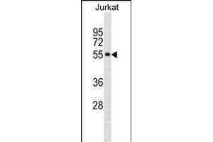 SF3A2 Antibody (Center) (ABIN1881795 and ABIN2838933) western blot analysis in Jurkat cell line lysates (35 μg/lane). (SF3A2 Antikörper  (AA 166-194))