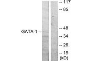 Western Blotting (WB) image for anti-GATA Binding Protein 1 (Globin Transcription Factor 1) (GATA1) (AA 277-326) antibody (ABIN2888995) (GATA1 Antikörper  (AA 277-326))