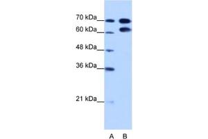 Western Blotting (WB) image for anti-Ribonucleoprotein, PTB-Binding 1 (RAVER1) antibody (ABIN2462325) (RAVER1 Antikörper)
