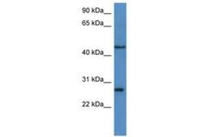 Image no. 1 for anti-Fibroblast Growth Factor Binding Protein 2 (FGFBP2) (C-Term) antibody (ABIN6746863) (FGFBP2 Antikörper  (C-Term))
