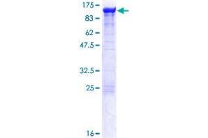 alpha Actinin 4 Protein (AA 1-911) (GST tag)