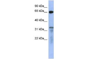 WB Suggested Anti-RAP1GAP  Antibody Titration: 0. (RAP1GAP Antikörper  (Middle Region))