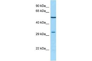 WB Suggested Anti-MAGEA12 Antibody Titration: 1.