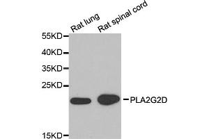 Western blot analysis of extracts of various cell lines, using PLA2G2D antibody (ABIN5974308) at 1/1000 dilution.
