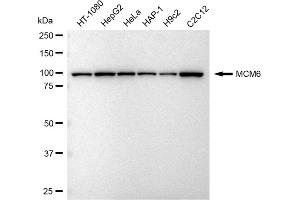 Western blotting analysis using MCM6 antibody (ABIN7799421). (Rekombinanter MCM6 Antikörper)