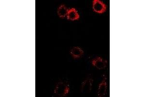 Immunofluorescent analysis of HSD17B2 staining in SW480 cells.
