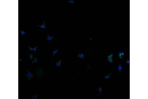 Immunofluorescence staining of SH-SY5Y cells with ABIN7170135 at 1:100, counter-stained with DAPI. (SLC22A10 Antikörper  (AA 37-145))