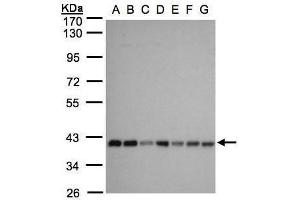 WB Image Sample(30 ug whole cell lysate) A: 293T B: A431 , C: H1299 D: HeLa S3 , E: Hep G2 , F: MOLT4 , G: Raji , 10% SDS PAGE antibody diluted at 1:1000 (SLC25A33 Antikörper)