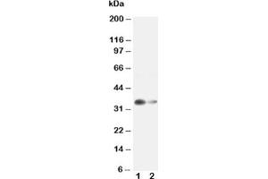Western Blotting (WB) image for anti-Arginase, Liver (ARG1) (AA 307-323) antibody (ABIN3030018)