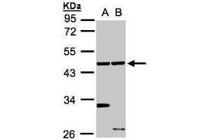 WB Image Sample(30 ug whole cell lysate) A:A431, B:Hep G2 , 10% SDS PAGE antibody diluted at 1:1000 (Ethanolamine Kinase 1 Antikörper)