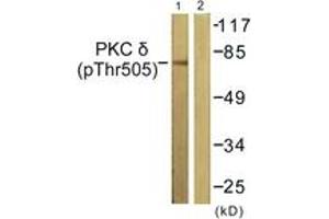 Western blot analysis of extracts from NIH-3T3 cells treated with UV 15', using PKC delta (Phospho-Thr505) Antibody.