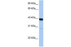 WB Suggested Anti-ZNF385B Antibody Titration:  0. (ZNF385B Antikörper  (C-Term))