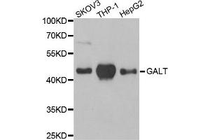 Western Blotting (WB) image for anti-Galactose-1-Phosphate Uridylyltransferase (GALT) antibody (ABIN1980308) (GALT Antikörper)