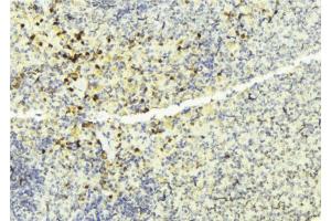 ABIN6274137 at 1/100 staining Mouse liver tissue by IHC-P. (TNFRSF6B Antikörper)