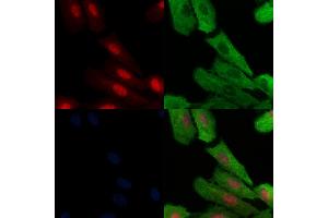 Phospho-MAFB (Ser304) Antibody staining A549 cells(H2O2 treatment) by IF/ICC.