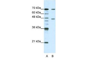 PABPC4 antibody used at 1.