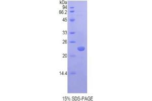 SDS-PAGE analysis of Mouse Chromobox Homolog 3 Protein. (CBX3 Protein)
