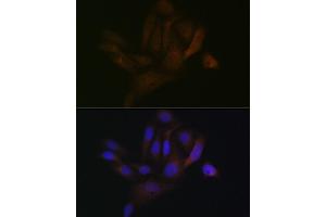 Immunofluorescence analysis of U-2 OS cells using B Rabbit mAb (ABIN1680181, ABIN7101458, ABIN7101459 and ABIN7101460) at dilution of 1:100 (40x lens). (BCAP31 Antikörper)