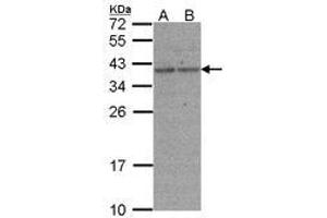 Image no. 1 for anti-X-Ray Repair Complementing Defective Repair in Chinese Hamster Cells 3 (XRCC3) (AA 1-128) antibody (ABIN467379) (XRCC3 Antikörper  (AA 1-128))