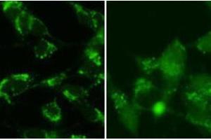 Immunohistochemistry (IHC) image for anti-Microtubule-Associated Protein 1 Light Chain 3 beta (MAP1LC3B) (cleaved) antibody (ABIN2999910) (LC3B Antikörper  (cleaved))