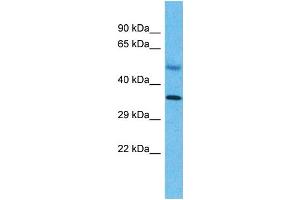 Host:  Rabbit  Target Name:  SNAPC2  Sample Type:  Liver Tumor lysates  Antibody Dilution:  1. (SNAPC2 Antikörper  (C-Term))