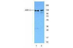 Western Blotting (WB) image for anti-WD Repeat and HMG-Box DNA Binding Protein 1 (WDHD1) antibody (ABIN2664053) (WDHD1 Antikörper)