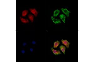 ABIN7094451 and ABIN7098499 staining Hela cells by IF/ICC.