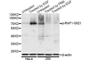 Western blot analysis of extracts of HeLa and 293T cells, using Phospho-RAF1-S621 antibody (ABIN5969931) at 1/1000 dilution. (RAF1 Antikörper  (pSer621))