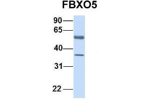 Host:  Rabbit  Target Name:  FBXO5  Sample Type:  Human Fetal Lung  Antibody Dilution:  1. (FBXO5 Antikörper  (C-Term))