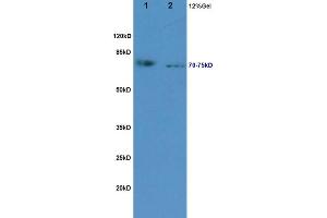 L1 rat kidney lysates L2 rat pancreas lysates probed with Anti NLG1/KIRREL2 Polyclonal Antibody, Unconjugated (ABIN720460) at 1:200 in 4 °C.