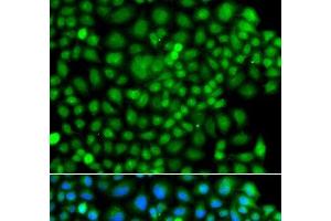 Immunofluorescence analysis of A549 cells using SUMO4 Polyclonal Antibody (SUMO4 Antikörper)