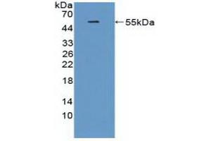 Figure. (TREM2 Antikörper  (AA 1-228))