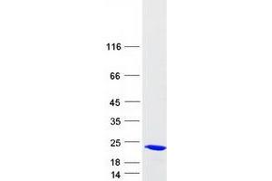 Western Blotting (WB) image for Spermidine/Spermine N1-Acetyltransferase 2 (SAT2) protein (Myc-DYKDDDDK Tag) (ABIN2731414)