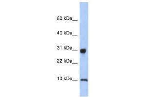 RPS21 antibody used at 1 ug/ml to detect target protein. (RPS21 Antikörper  (N-Term))