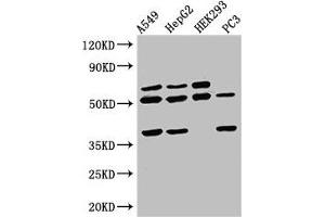 Western Blot Positive WB detected in: A549 whole cell lysate, HepG2 whole cell lysate, HEK293 whole cell lysate, PC-3 whole cell lysate All lanes: TAF1A antibody at 2.
