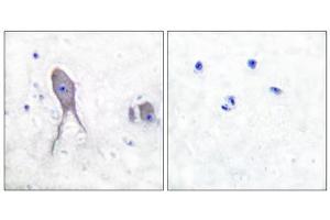 Immunohistochemical analysis of paraffin-embedded human brain tissue, using Notch 2 (cleaved-Asp1733) antibody. (NOTCH2 Antikörper  (Cleaved-Asp1733))