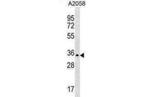 Western Blotting (WB) image for anti-Olfactory Receptor, Family 2, Subfamily T, Member 35 (OR2T35) antibody (ABIN3000665) (OR2T35 Antikörper)